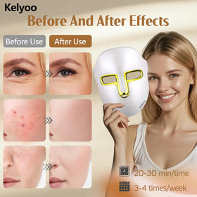 Masque de lumière LED Kelyoo avec câble de chargement Type-C