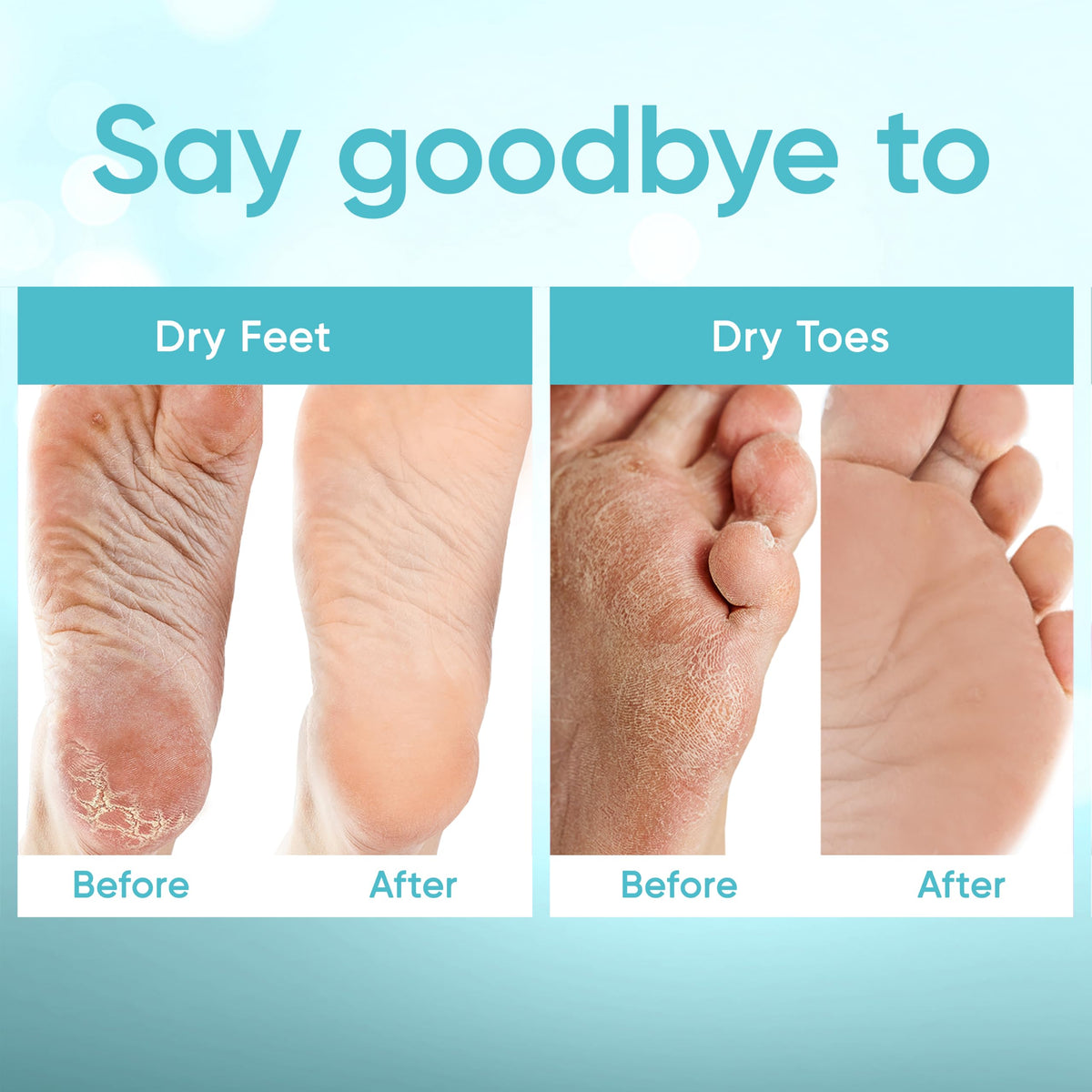Masque de pédicure CÉLOR en utilisation sur des pieds