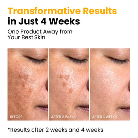 Masque hydratant au curcuma et acide kojique sur une peau apaisée