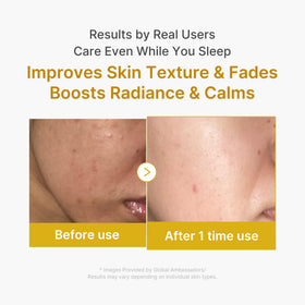 Masque medicube Kojic Acide Curcuma avant et après application