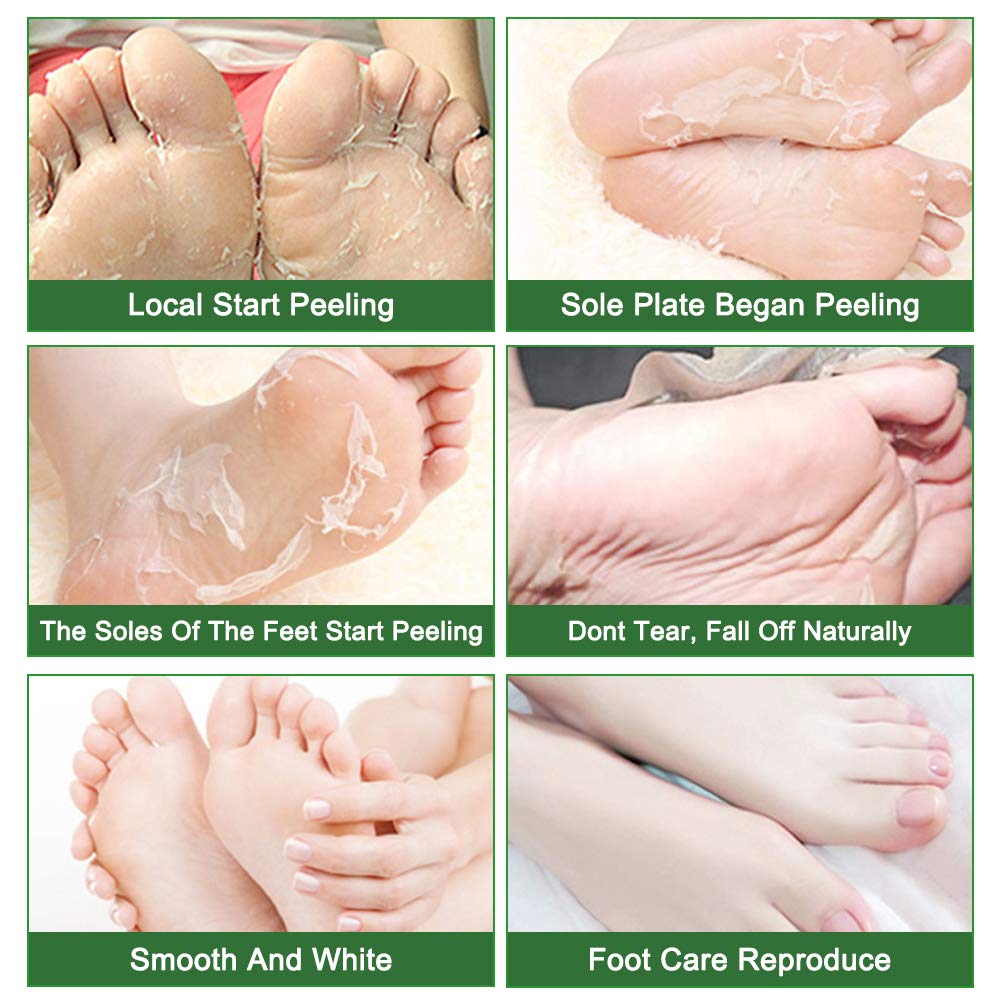 Masque pour pieds Liefiet porté sur des pieds, montrant l'application