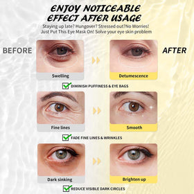 Masques contour des yeux Maskiss en couleur bleue, présentation individuelle