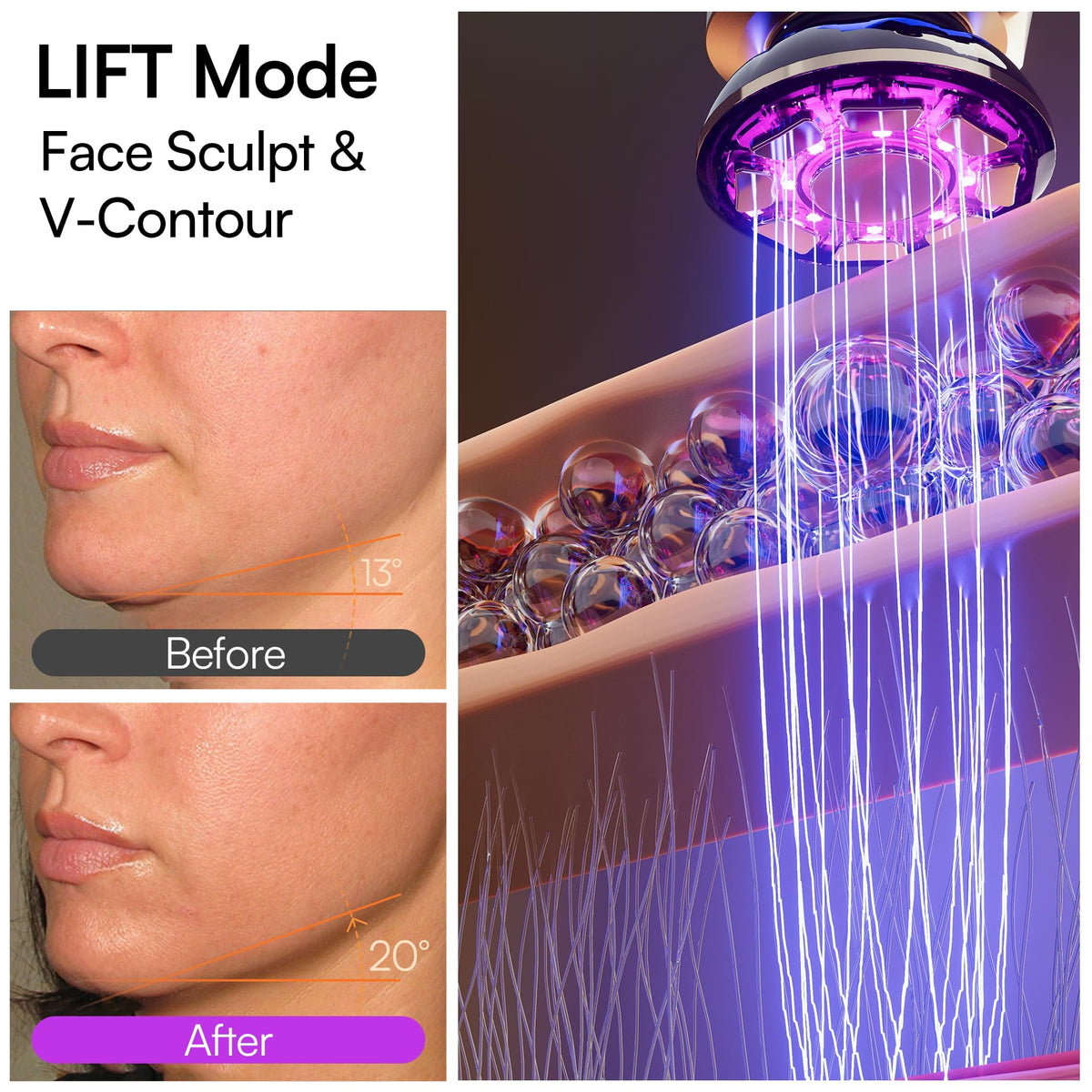 Mode TIGHTEN avec lumière rouge sur la peau
