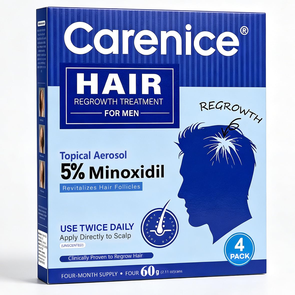 Mousse Minoxidil 5% CARENICE sur un fond neutre