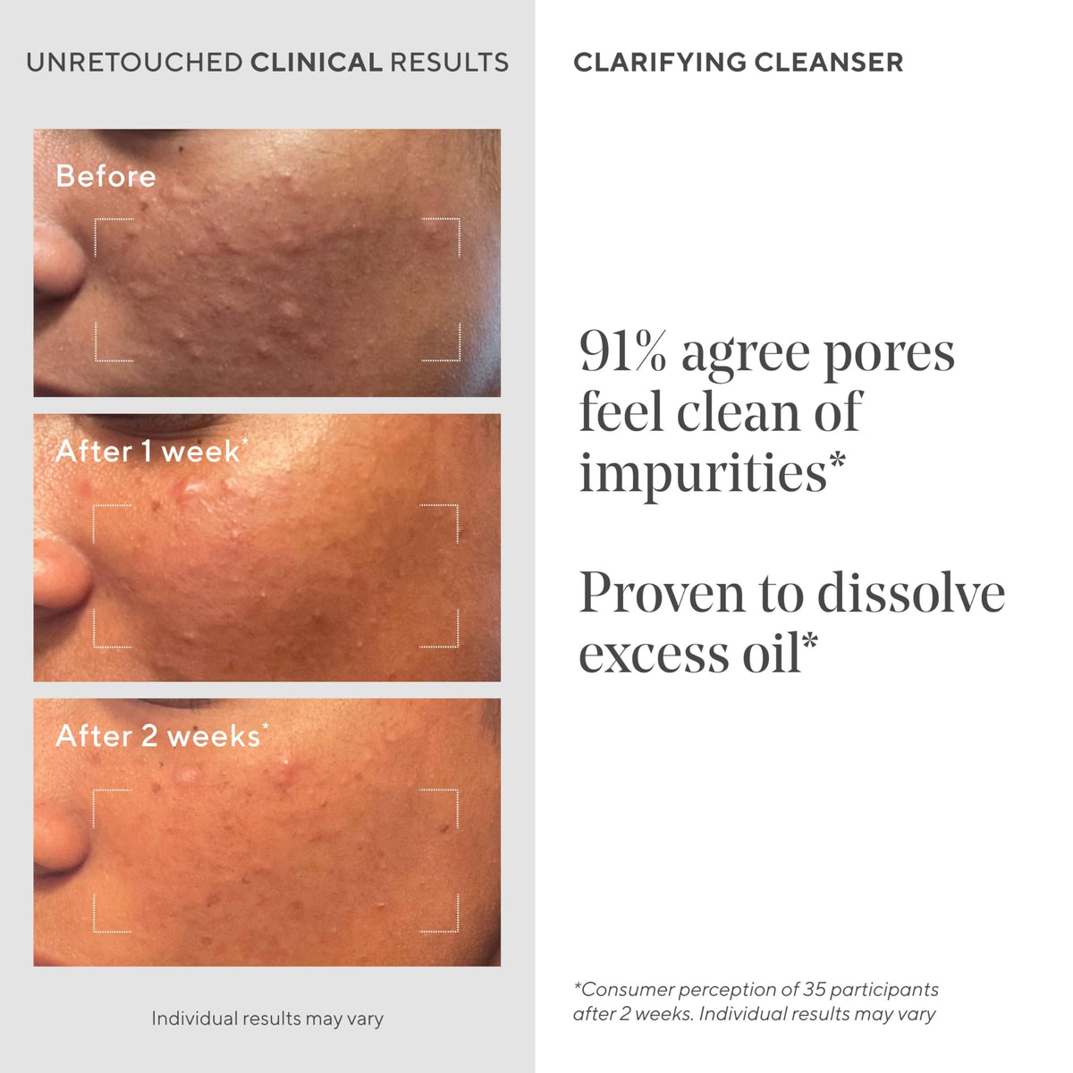 Murad Nettoyant Clarifiant Anti-Acné 500ml, texture du produit