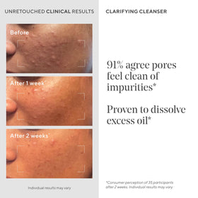 Murad Nettoyant Clarifiant Anti-Acné 500ml, texture du produit