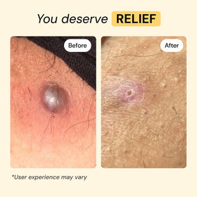 MyMagicHealer baume apaisant application sur la peau