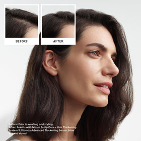 NIOXIN Kit Système 3 vue latérale des produits