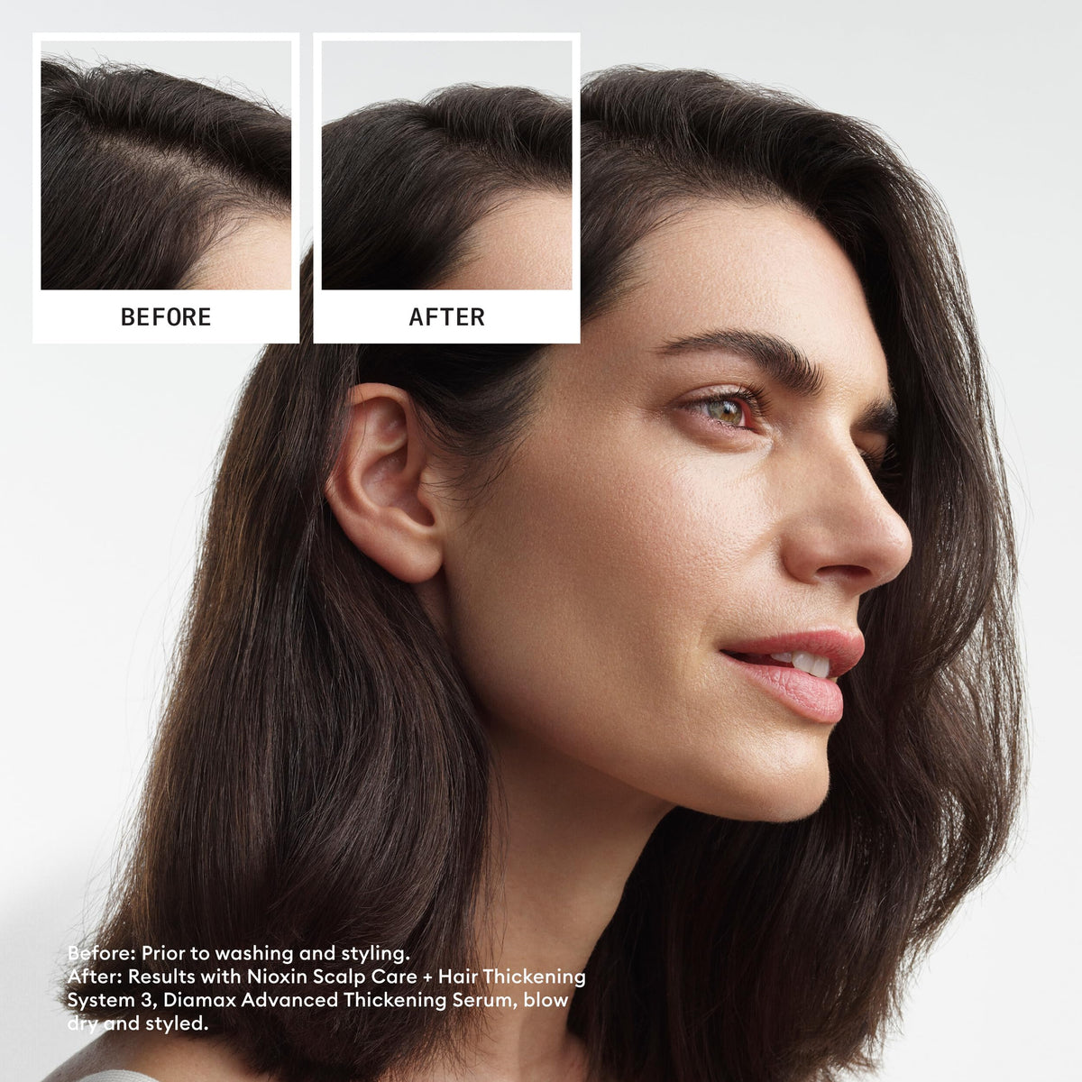 NIOXIN Système Kit 3 flacon de shampooing