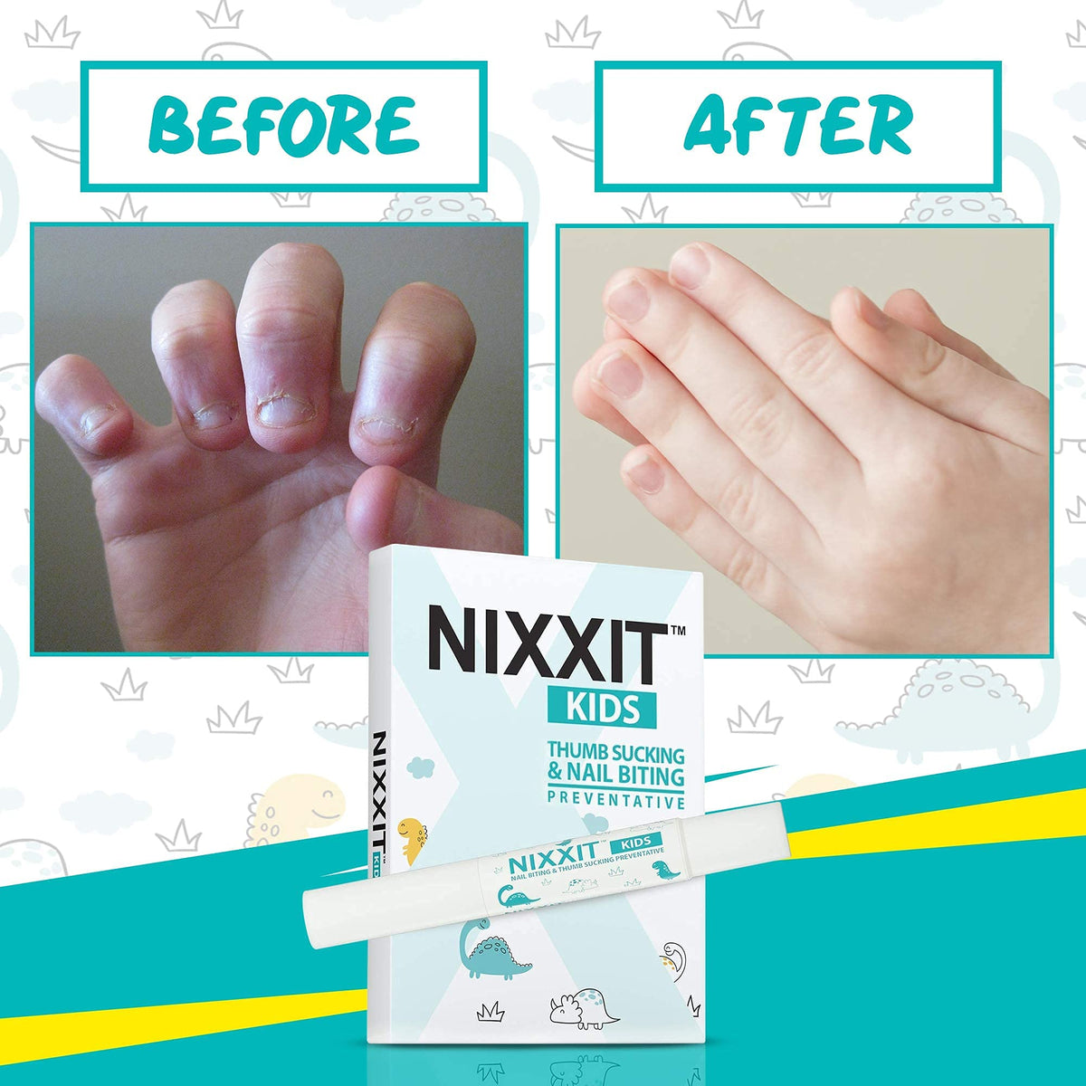 NIXXIT Traitement pour arrêter de ronger les ongles - Flacon ouvert