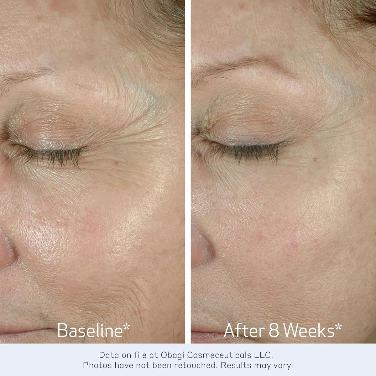 Obagi Medical ELASTIderm Crème pour les Yeux 82g - application sur la peau