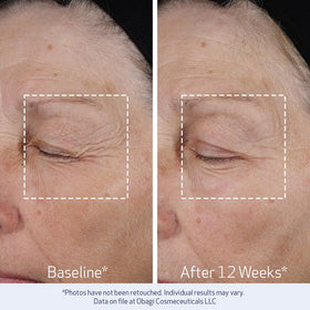 Obagi Medical ELASTIderm Lift Up Crème Hydratante sur une surface en bois