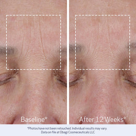 Obagi Medical ELASTIderm Lift Up Crème Hydratante vue de côté
