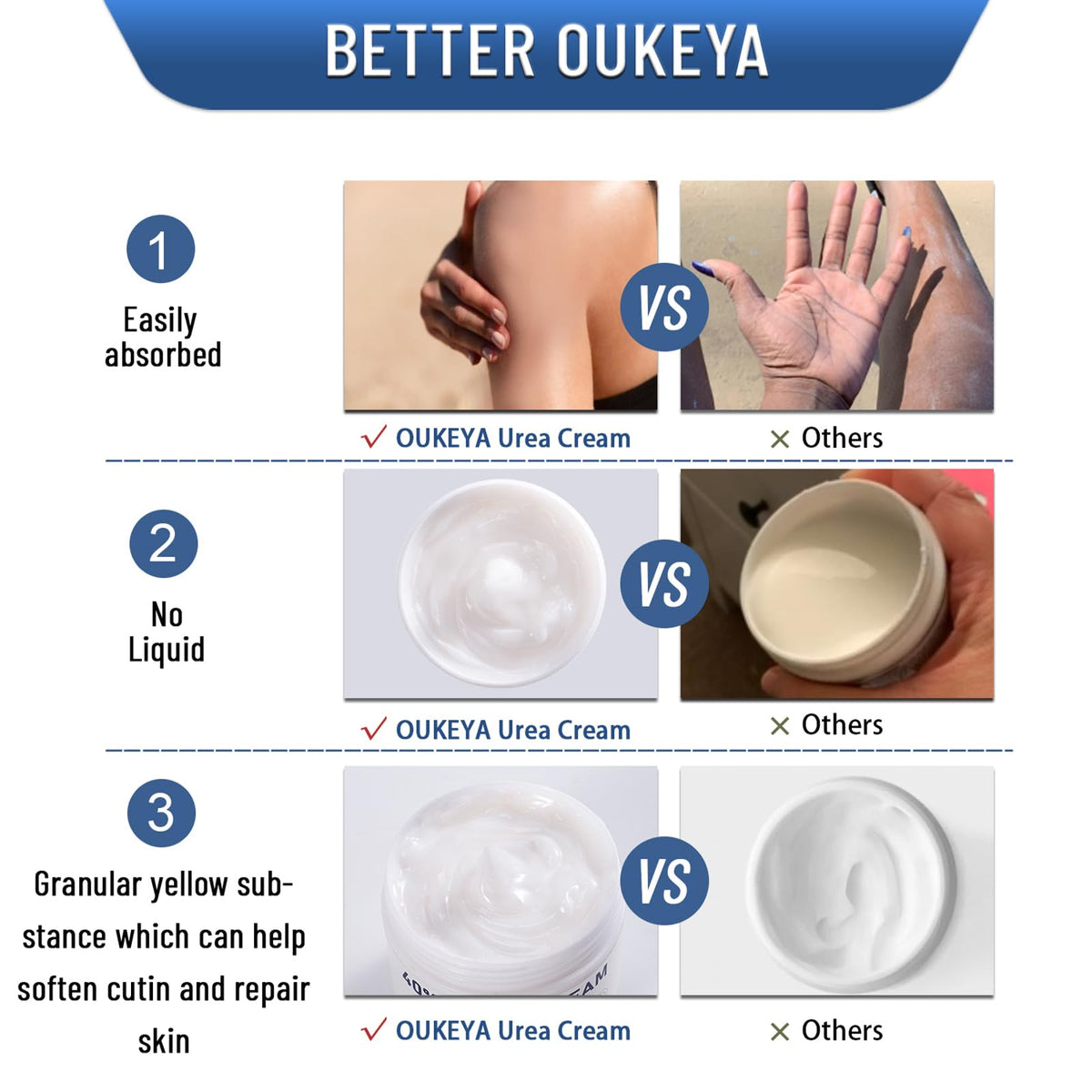 OUKEYA Crème Urée 40% application sur les pieds