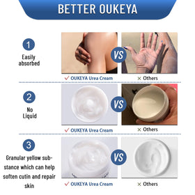 OUKEYA Crème Urée 40% application sur les pieds