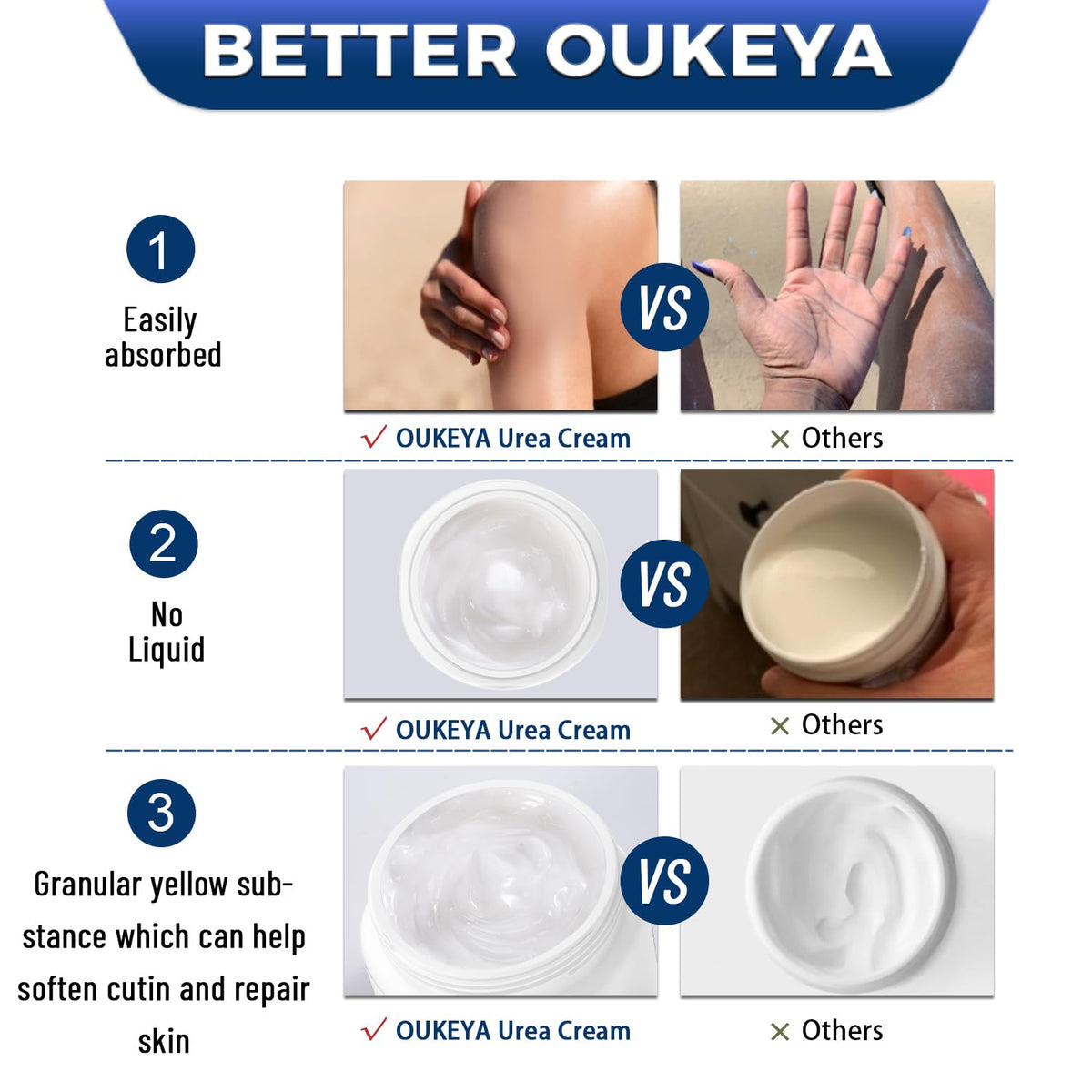 OUKEYA Crème Urée 40% sur une table avec des accessoires de beauté