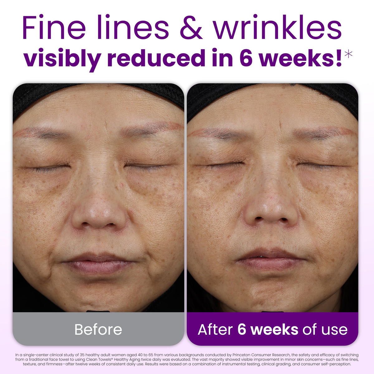 Pack de 100 serviettes visage CLEAN SKIN CLUB, présentation