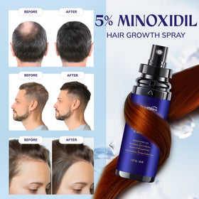 Pack de 2 flacons de sérum RootStim 5% Minoxidil