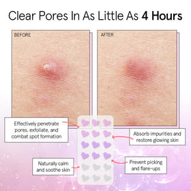 Patch anti-imperfection en forme de cœur violet