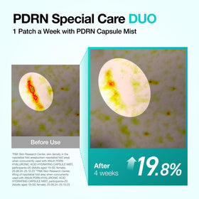 Patch ANUA PDRN appliqué sur la zone des sourires