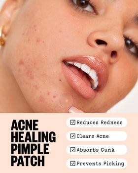 Patch hydrocolloïde PEACE OUT sur une imperfection du visage
