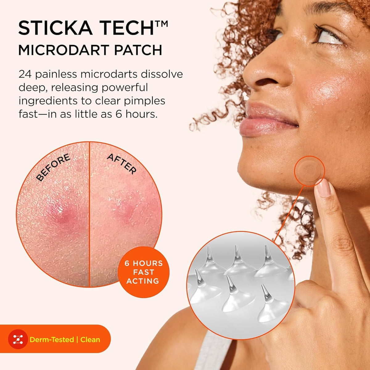 Patch ZitSticka Killa vue de près avec microdarts
