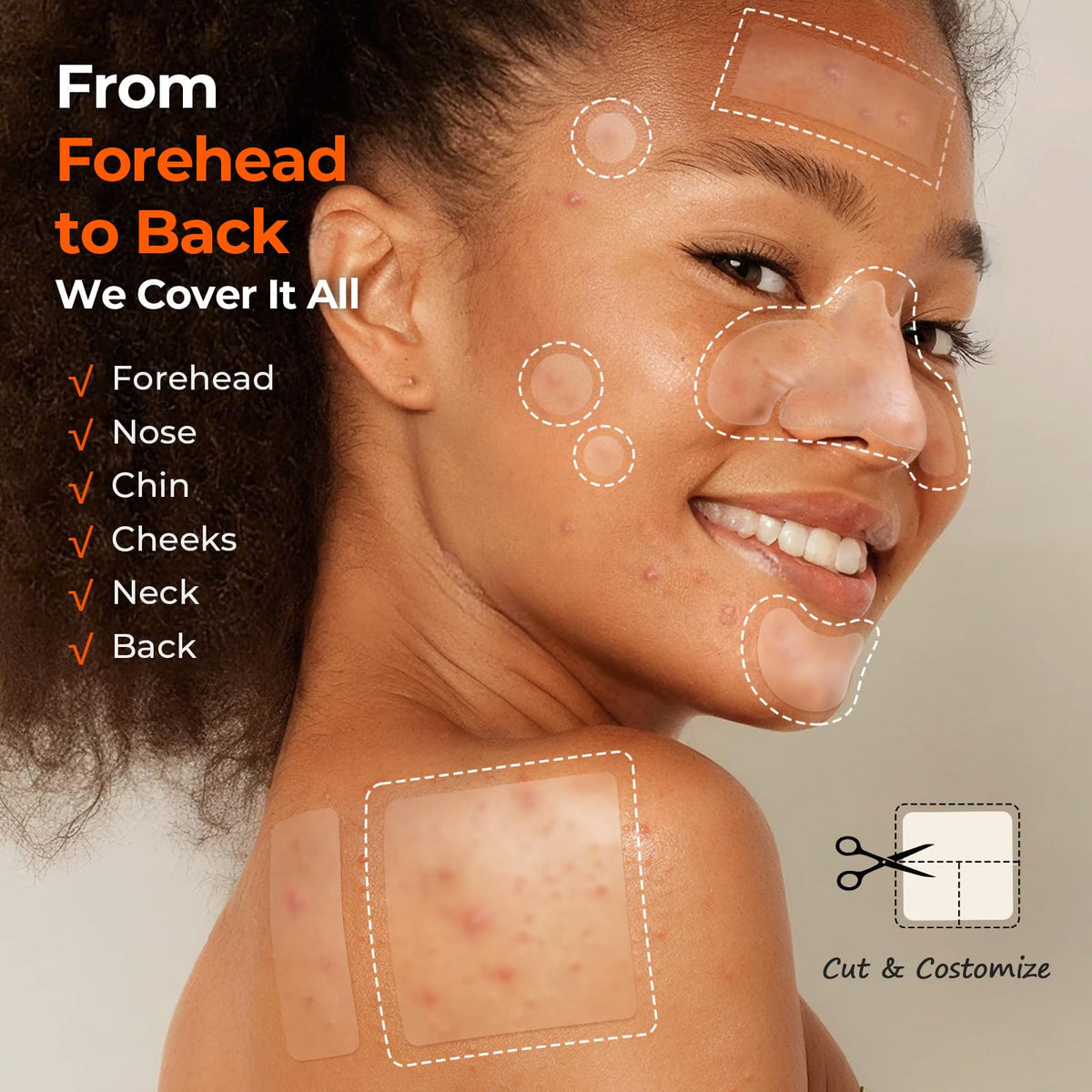 Patches anti-acné TKTK de 8 mm en utilisation sur le nez