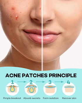 Patches TKTK sur un bureau avec des produits de beauté