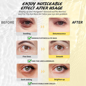 Patchs contour des yeux Maskiss avec acide hyaluronique