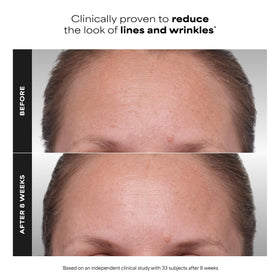 Paula's Choice CLINICAL 1% Retinol Traitement Visage et ses ingrédients