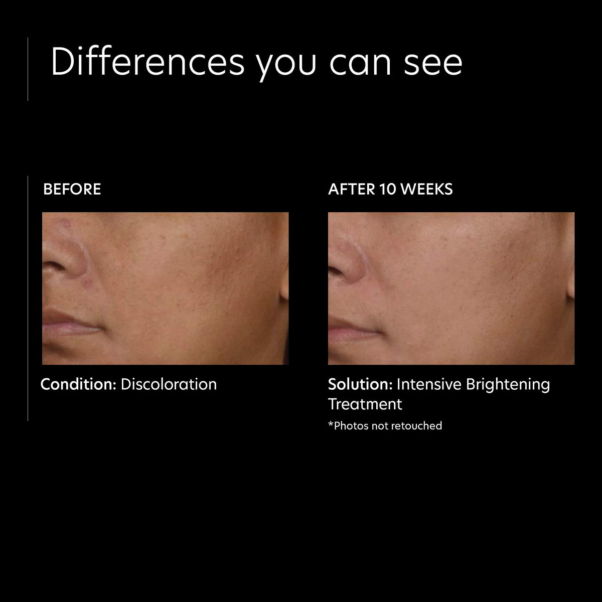 PCA SKIN Traitement Éclaircissant Intensif 50g application sur main