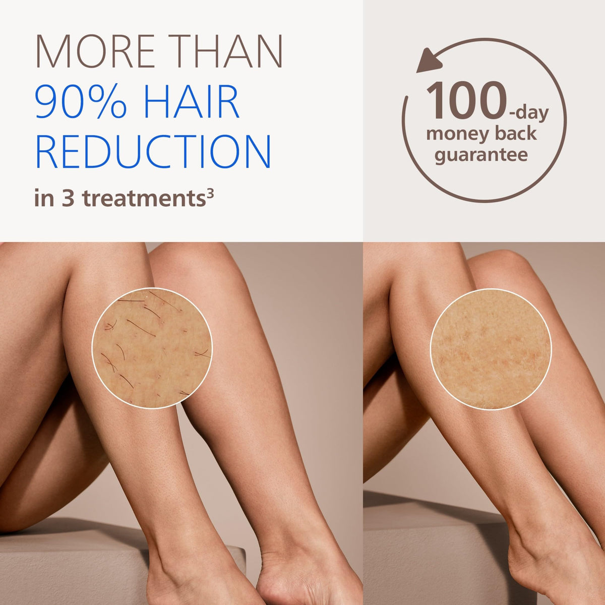 PHILIPS Lumea IPL 8000 avec embout pour le visage