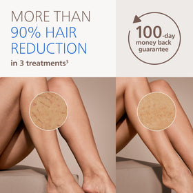 PHILIPS Lumea IPL BRI937/03 affichant les réglages de lumière