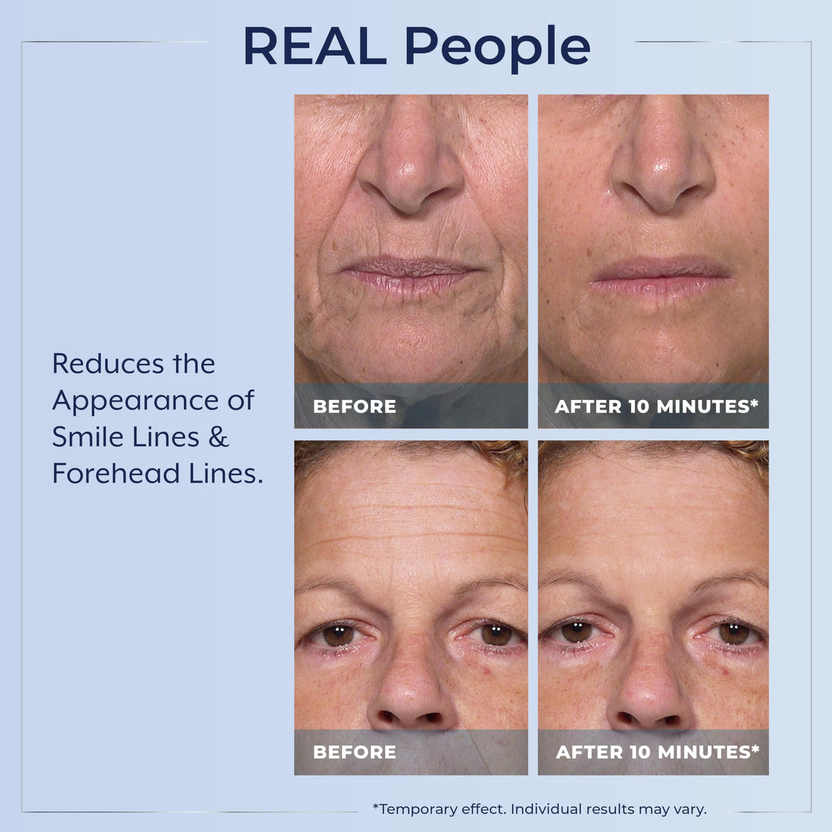 Plexaderm Sérum Contour des Yeux effet lissant