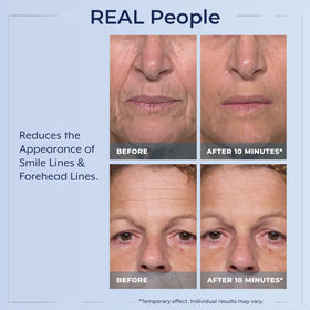 Plexaderm Sérum Contour des Yeux effet lissant
