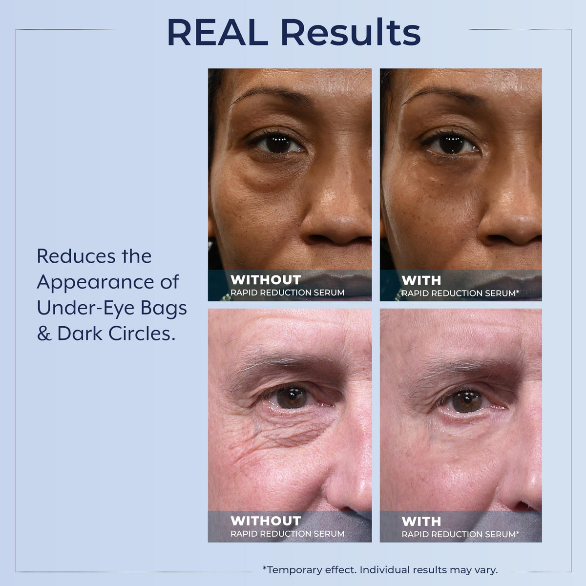 Plexaderm Sérum Contour des Yeux sur un fond neutre
