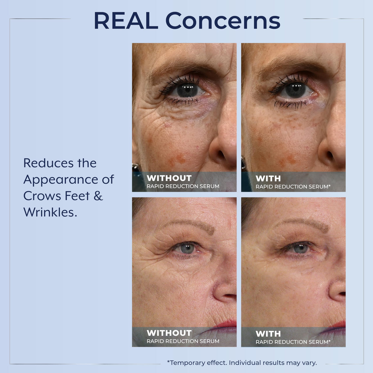 Plexaderm Sérum Contour des Yeux texture satinée