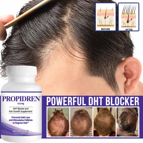 Pronexa Propidren complément anti-chute cheveux côté