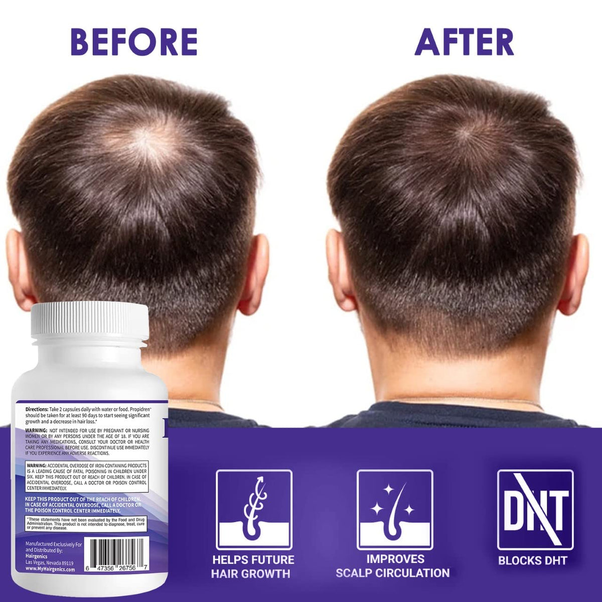 Pronexa Propidren complément anti-chute cheveux en lifestyle