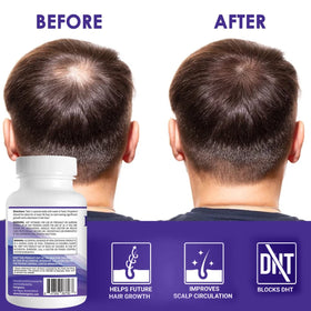 Pronexa Propidren complément anti-chute cheveux en lifestyle