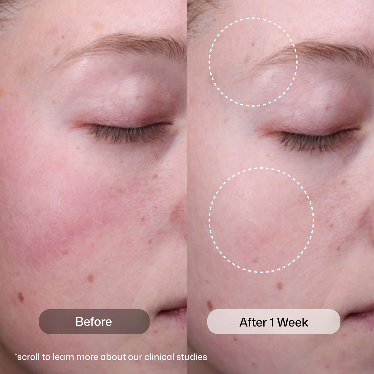 Revision Skincare Radiance+ Sérum Exfoliant avec texture liquide