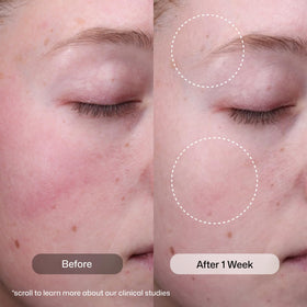 Revision Skincare Radiance+ Sérum Exfoliant avec texture liquide