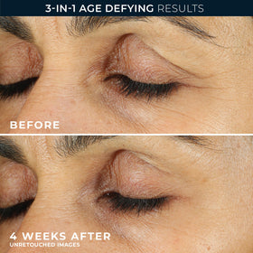RoC Crème Contour des Yeux Retinol Correxion packaging