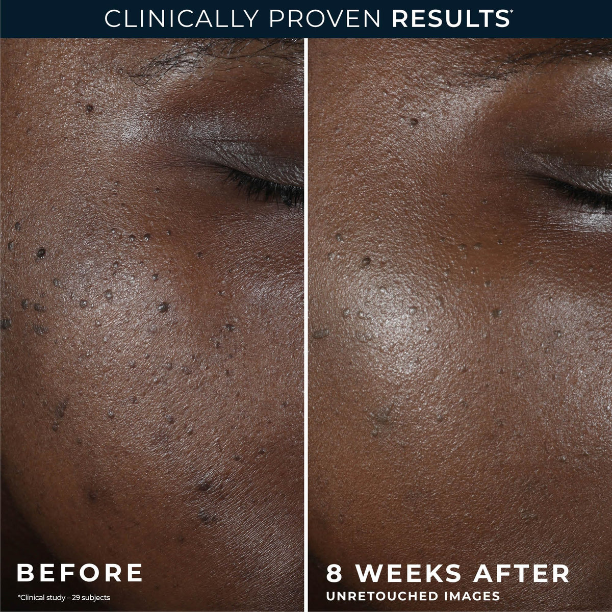 RoC Crème de Nuit Équilibre + Lift 249g vue de côté