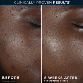 RoC Crème de Nuit Équilibre + Lift 249g vue de côté