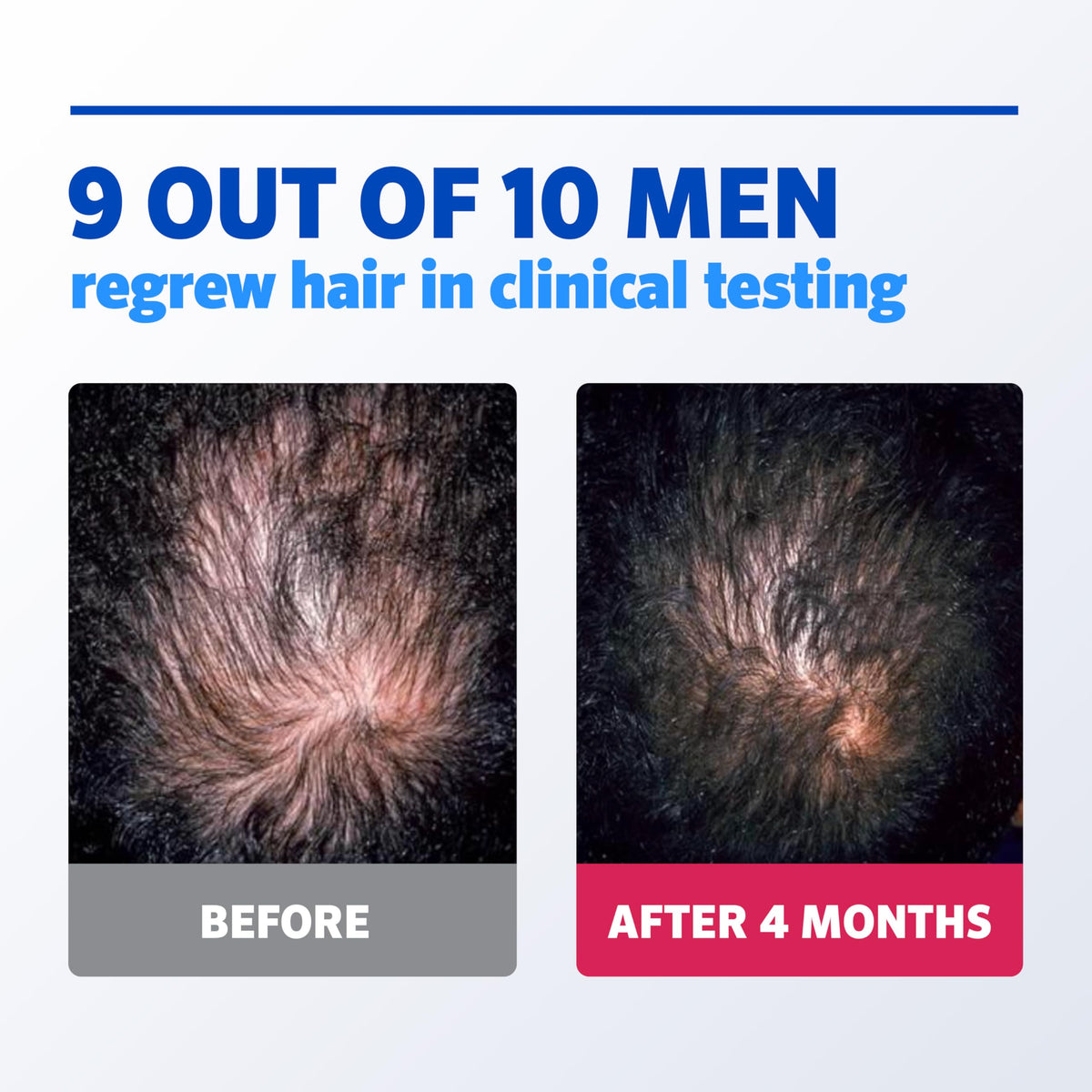 Rogaine Foam 5% Minoxidil, affichage des ingrédients