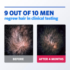 Rogaine Foam 5% Minoxidil, affichage des ingrédients