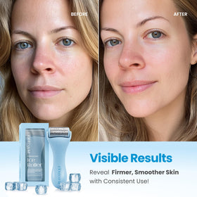 Rouleau de glace PLANTIFIQUE en action sur le visage