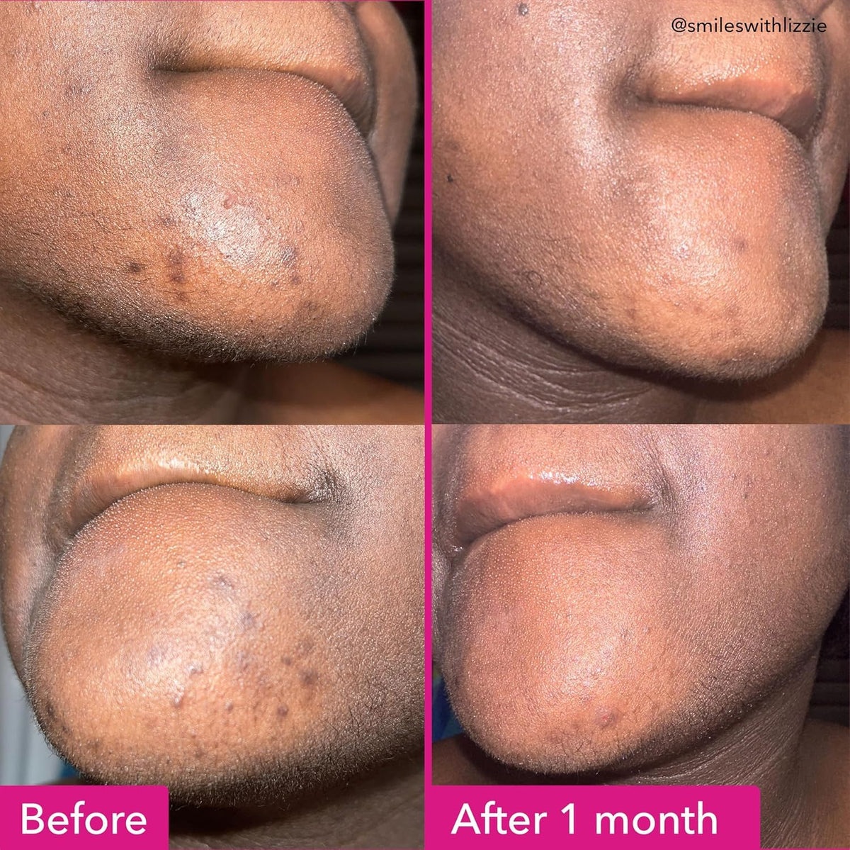 Savon éclaircissant Good Molecules sur une surface avec mousse
