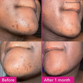 Savon éclaircissant Good Molecules sur une surface avec mousse
